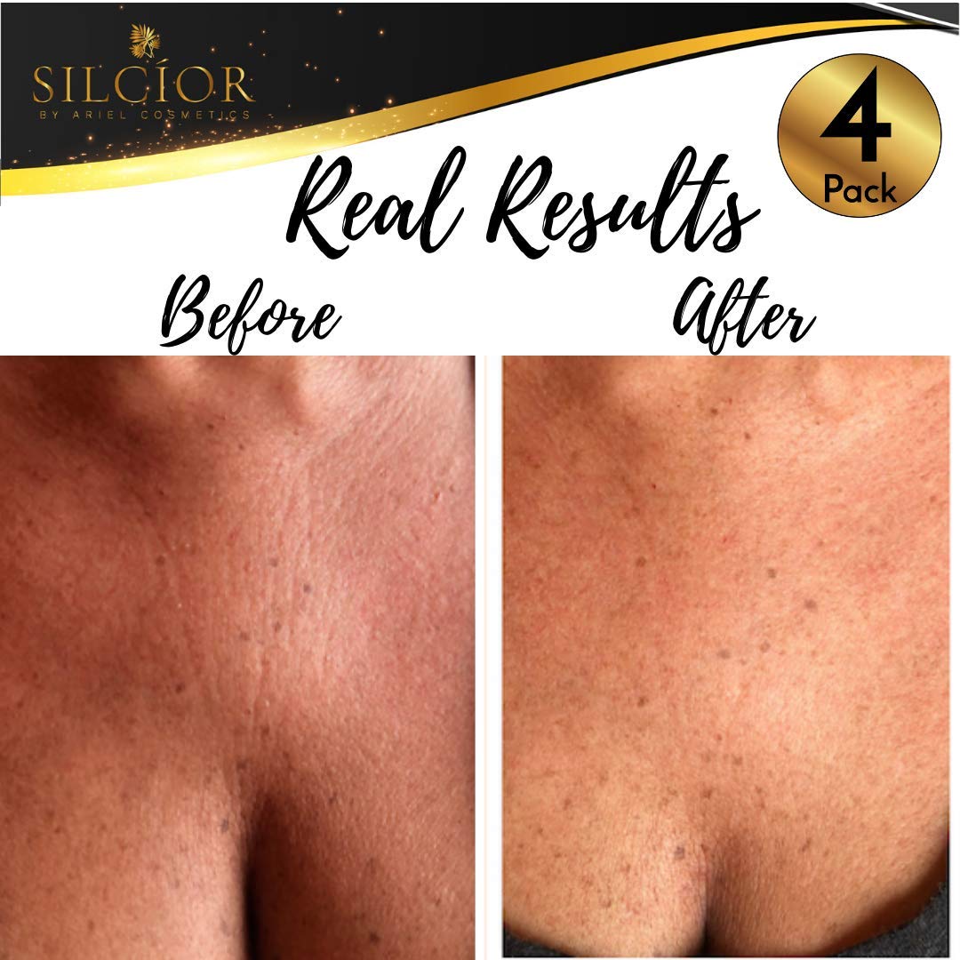 SILCIOR hypoallergenic skin-friendly chest pad safe for sensitive skin.