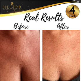 SILCIOR hypoallergenic skin-friendly chest pad safe for sensitive skin.