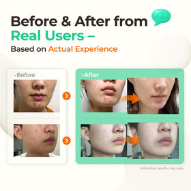 SINSURU Watery Sulfur 82 serum dispensing closeup shows easy application