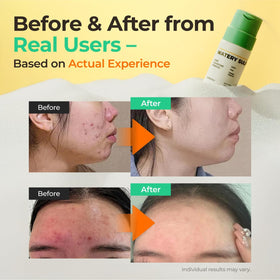 SINSURU Watery Sulfur Powder purifying-pores effect on skin texture