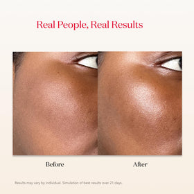 Kinren extract label emphasizes natural firmness boost within the formula.