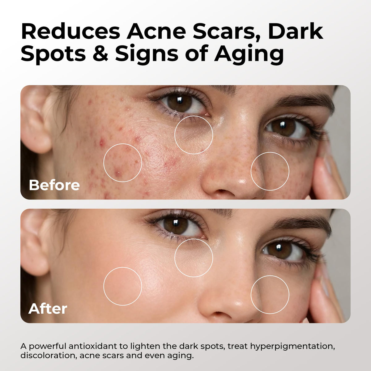 Skin Deva serum ferulic acid illustration highlighting antioxidant protection.