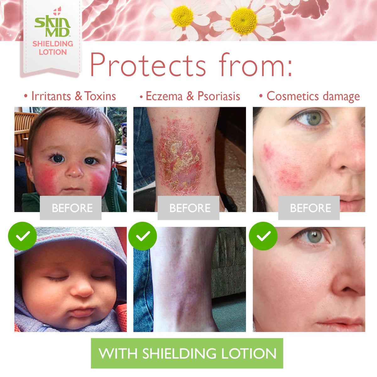 Skin MD Natural Shielding Lotion fragrance-free formula ideal for fragrance-sensitive users.