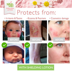 Skin MD Natural Shielding Lotion fragrance-free formula ideal for fragrance-sensitive users.