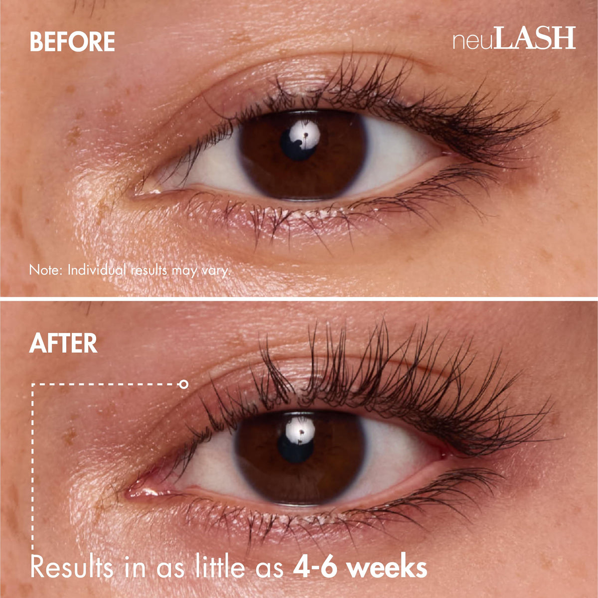 1 mL neuLASH bottle shown with clean packaging.