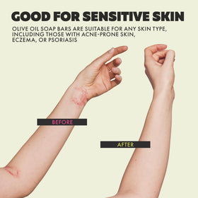 Skin Said Yes olive oil bar soap suitable for sensitive and acne-prone skin.
