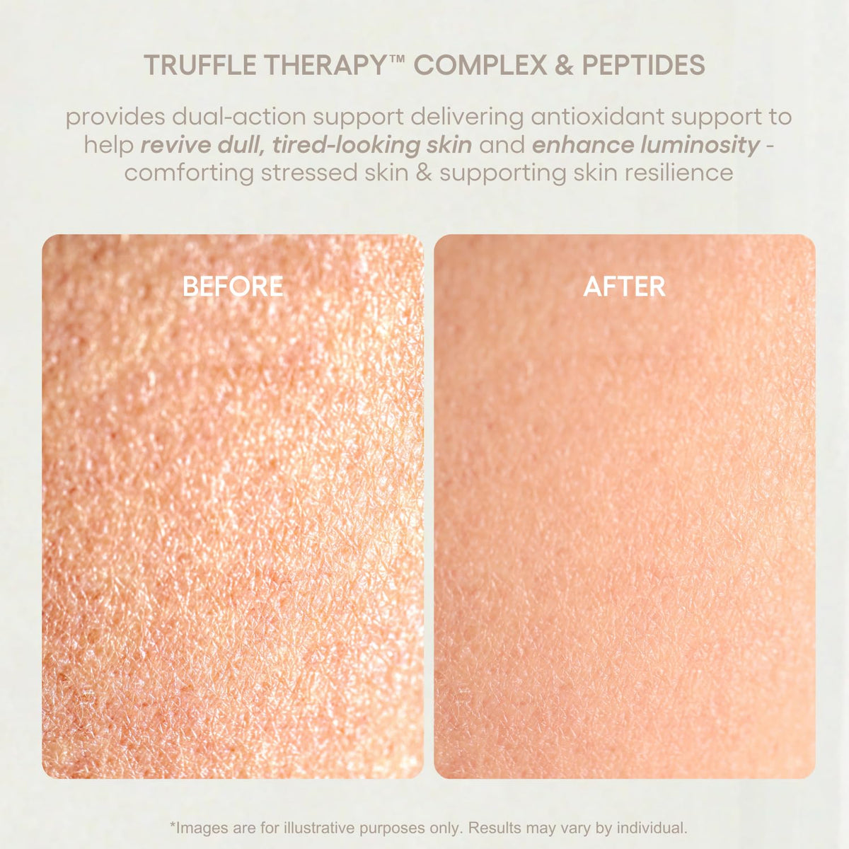 Fresh, balanced skin after using SKIN&CO Roma Truffle Therapy toner