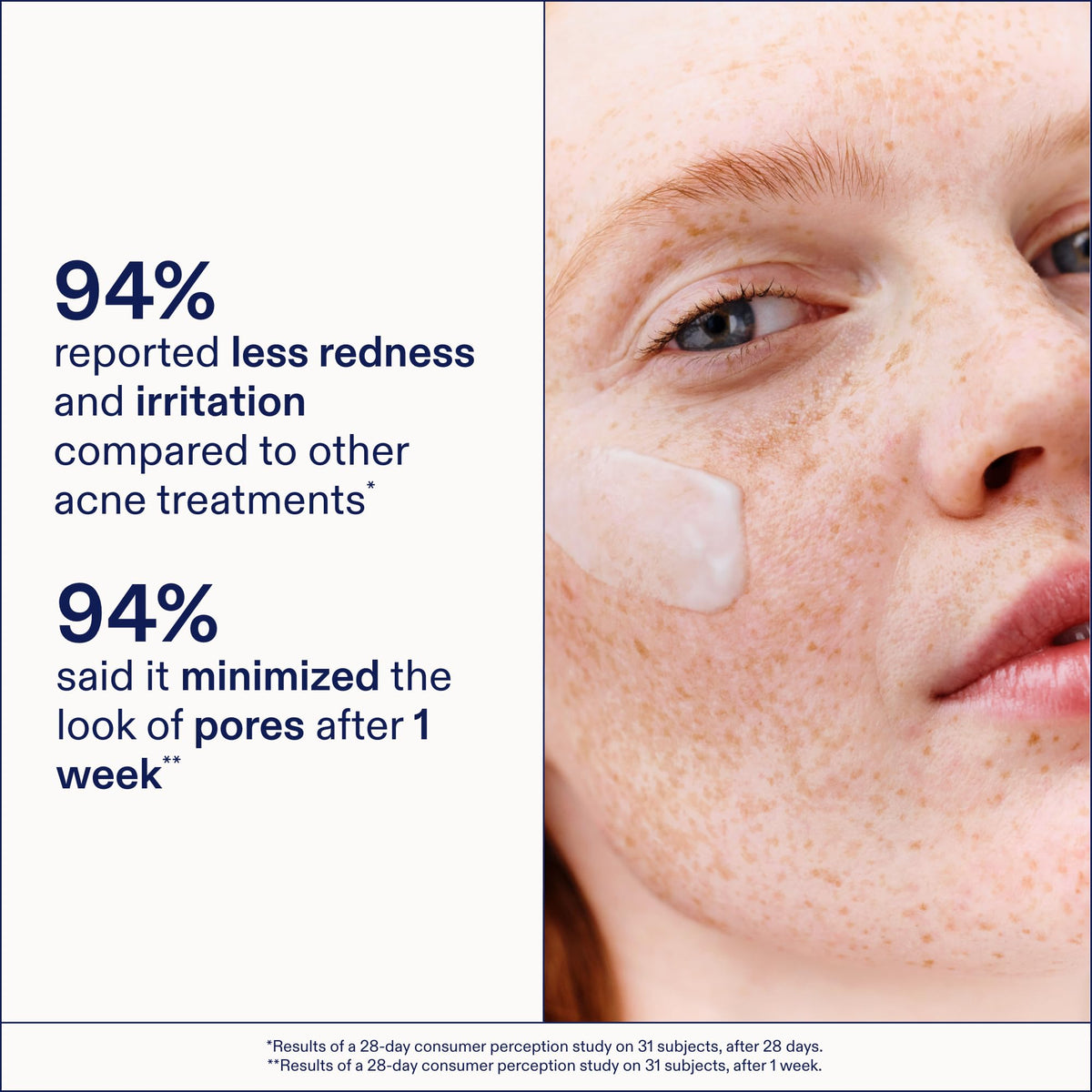 Skinfix Adapinoid Gel ingredients Niacinamide promoting pore minimization.