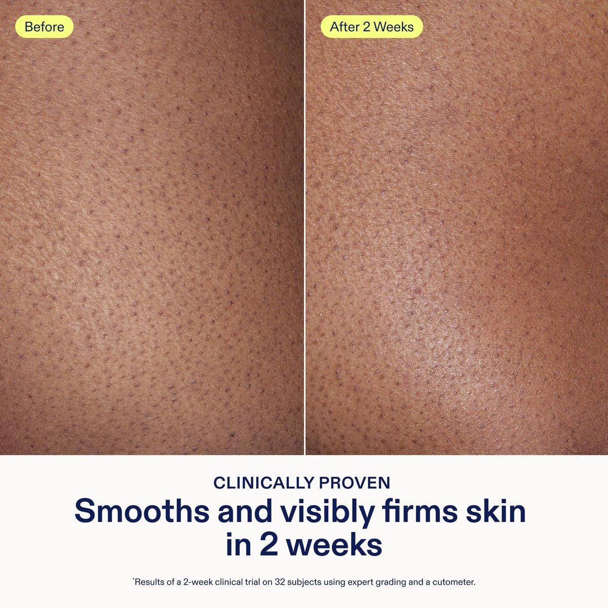 Skinfix apply body cream hands demonstrates application on arms for smoother softer skin