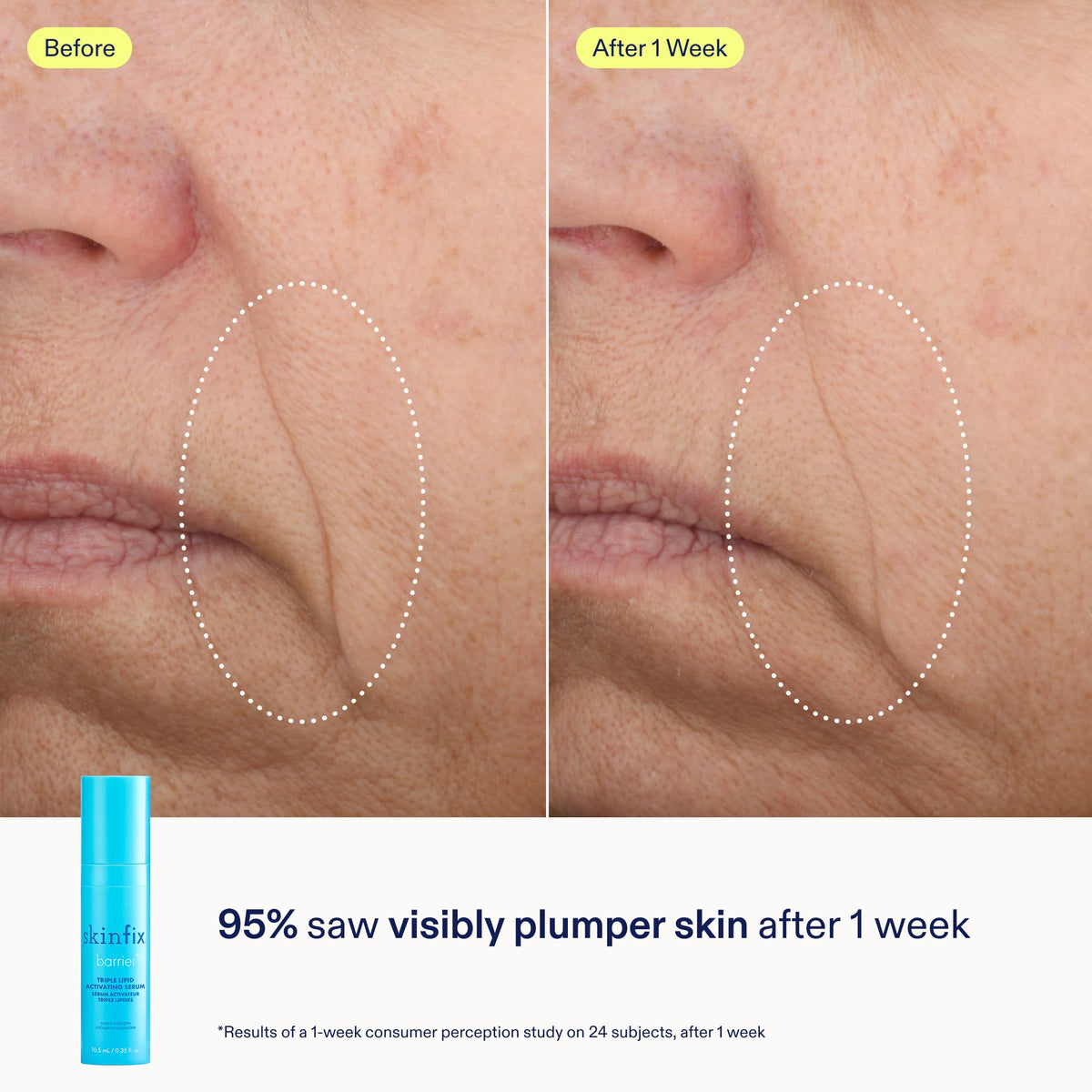 Skinfix Barrier+ Kit cleanser foam close-up conveys delicate cleansing