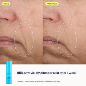 Skinfix Barrier+ Kit cleanser foam close-up conveys delicate cleansing