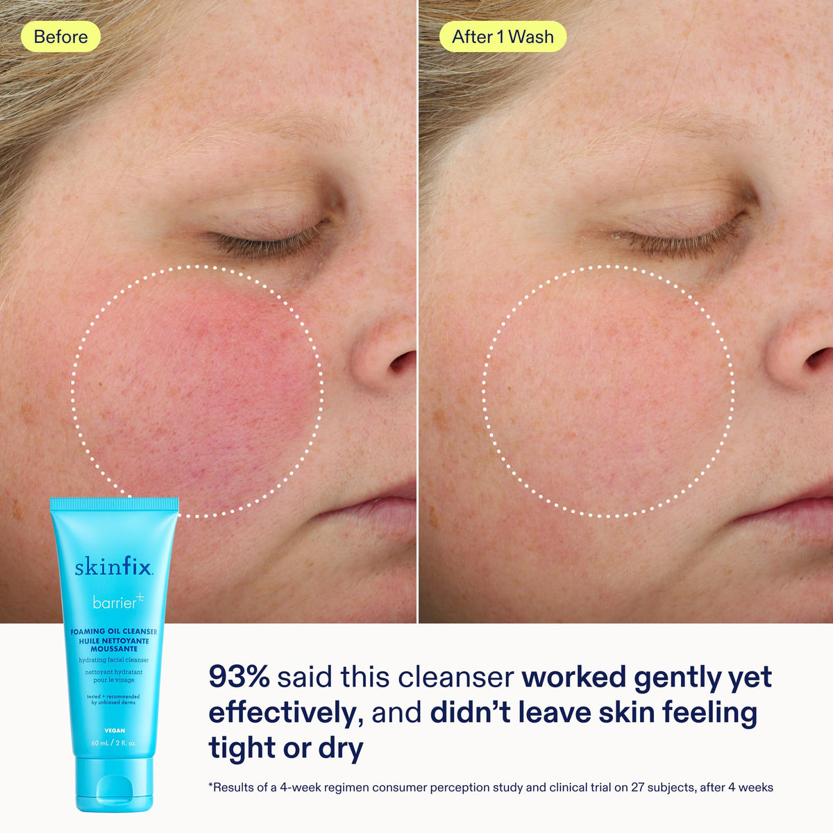 Skinfix Barrier+ Kit triple lipid-activating serum dropper close-up for radiant skin