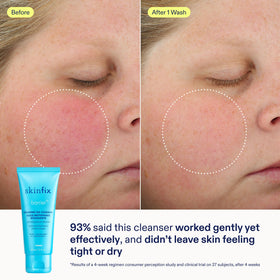 Skinfix Barrier+ Kit triple lipid-activating serum dropper close-up for radiant skin
