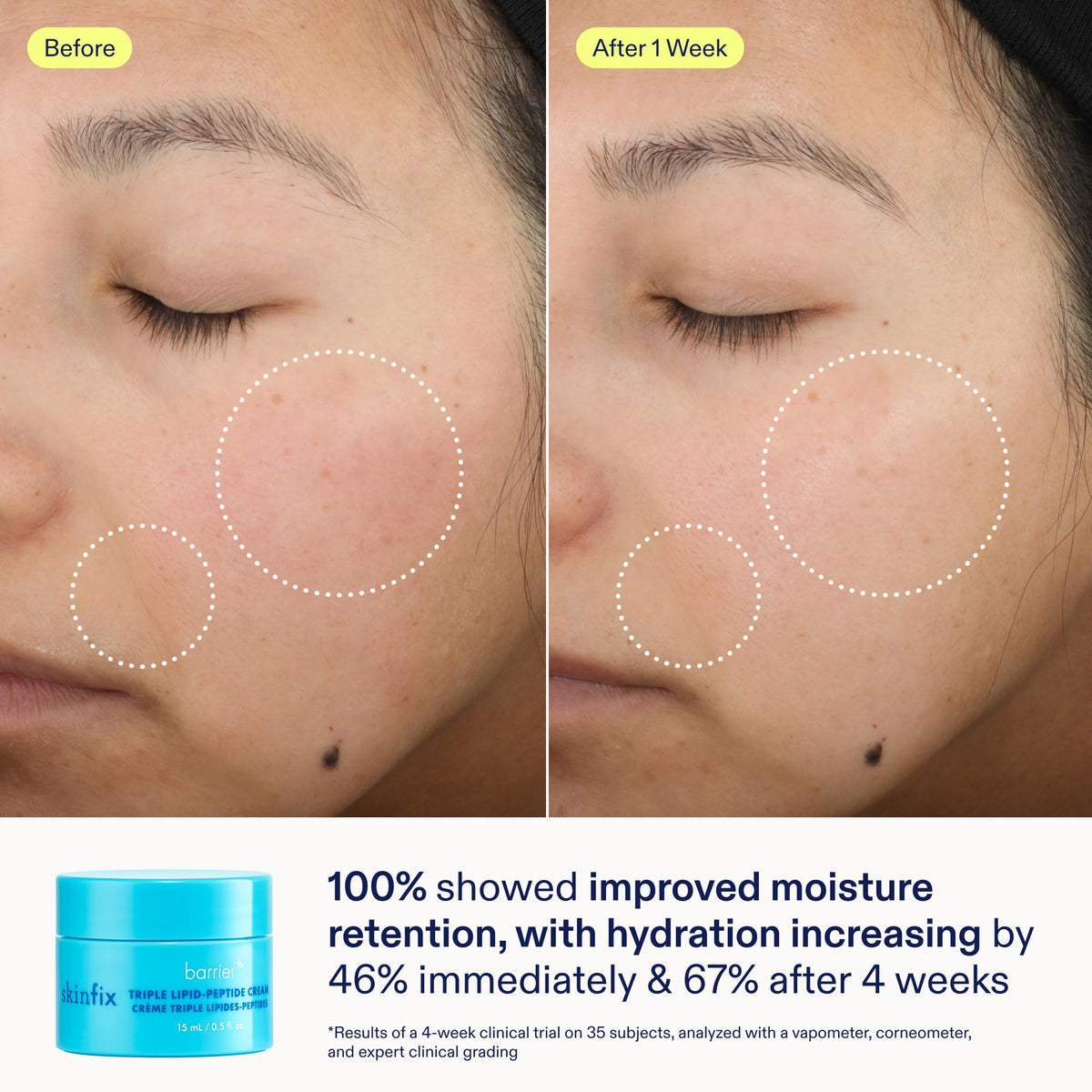 Skinfix Barrier+ Kit branding close-up on packaging