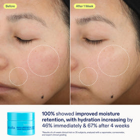 Skinfix Barrier+ Kit branding close-up on packaging