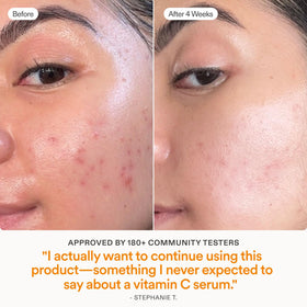 Skinfix Brighten and Firm Serum application routine image shows step-by-step usage.