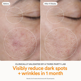 Skinfix Brighten and Firm ingredients graphic explains 15% THD vitamin C and peptides.