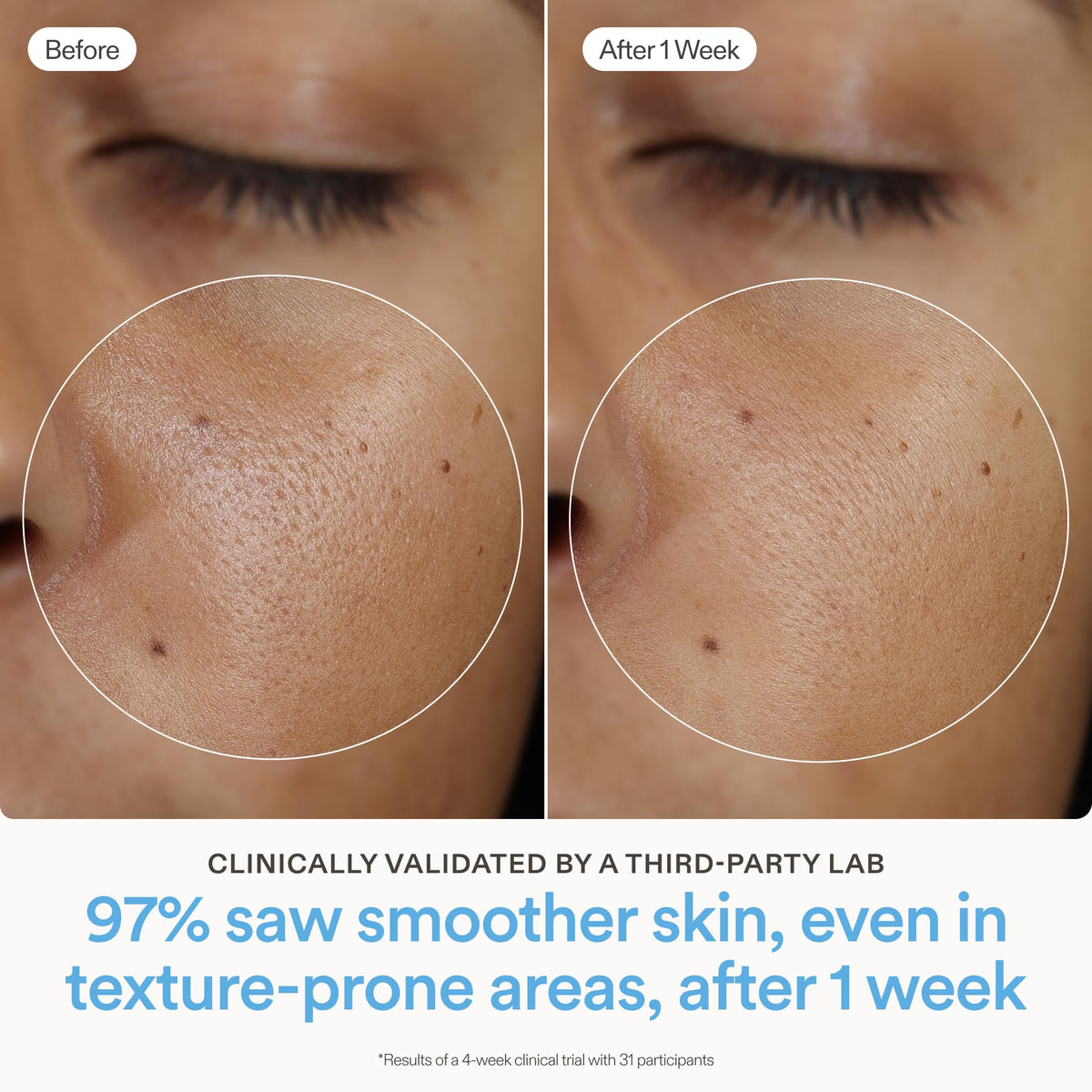 Close-up of Skinfix Ceramide Prime Whipped Cream ingredients emphasizing ceramide complex hydration.