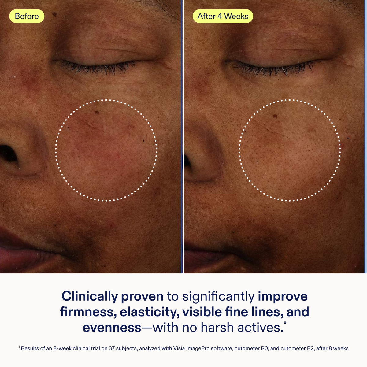 Skinfix Exo + Ectoin Intensive Repair Baume airless dispenser is easy to use