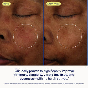 Skinfix Exo + Ectoin Intensive Repair Baume airless dispenser is easy to use
