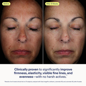 Skinfix Exo + Ectoin Intensive Repair Baume application demonstrates gentle spreading