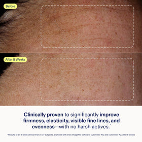 Skinfix Exo + Ectoin Intensive Repair Baume ingredients highlight peptides and exosomes