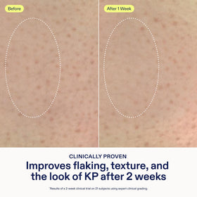 Close-up texture of Skinfix cream showing whipped, hydrating consistency for softer skin.