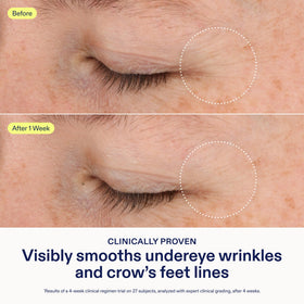 Texture close-up of Skinfix Triple Lipid-Boost 360 Eye cream for sensitive skin