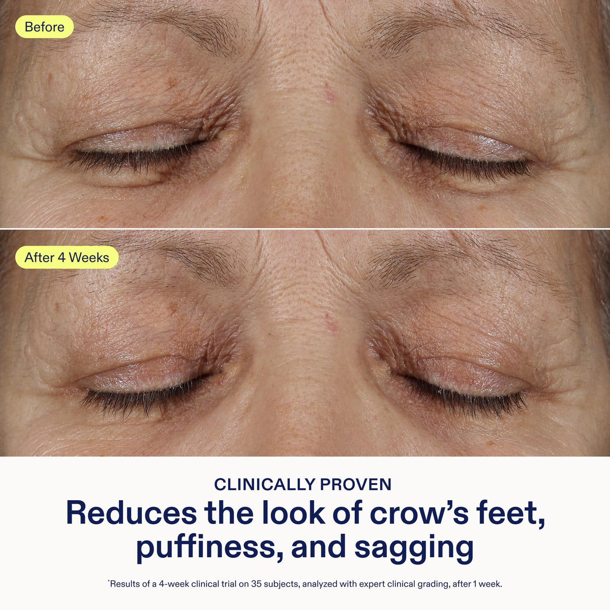 Gently tapping Skinfix under-eye area during application.
