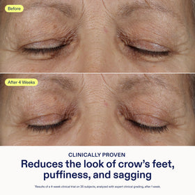 Gently tapping Skinfix under-eye area during application.