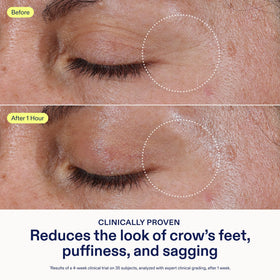 Close-up of Skinfix under-eye area with smooth texture.