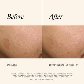 SkinMedica Even & Correct packaging highlights concentrated dark spot solution.