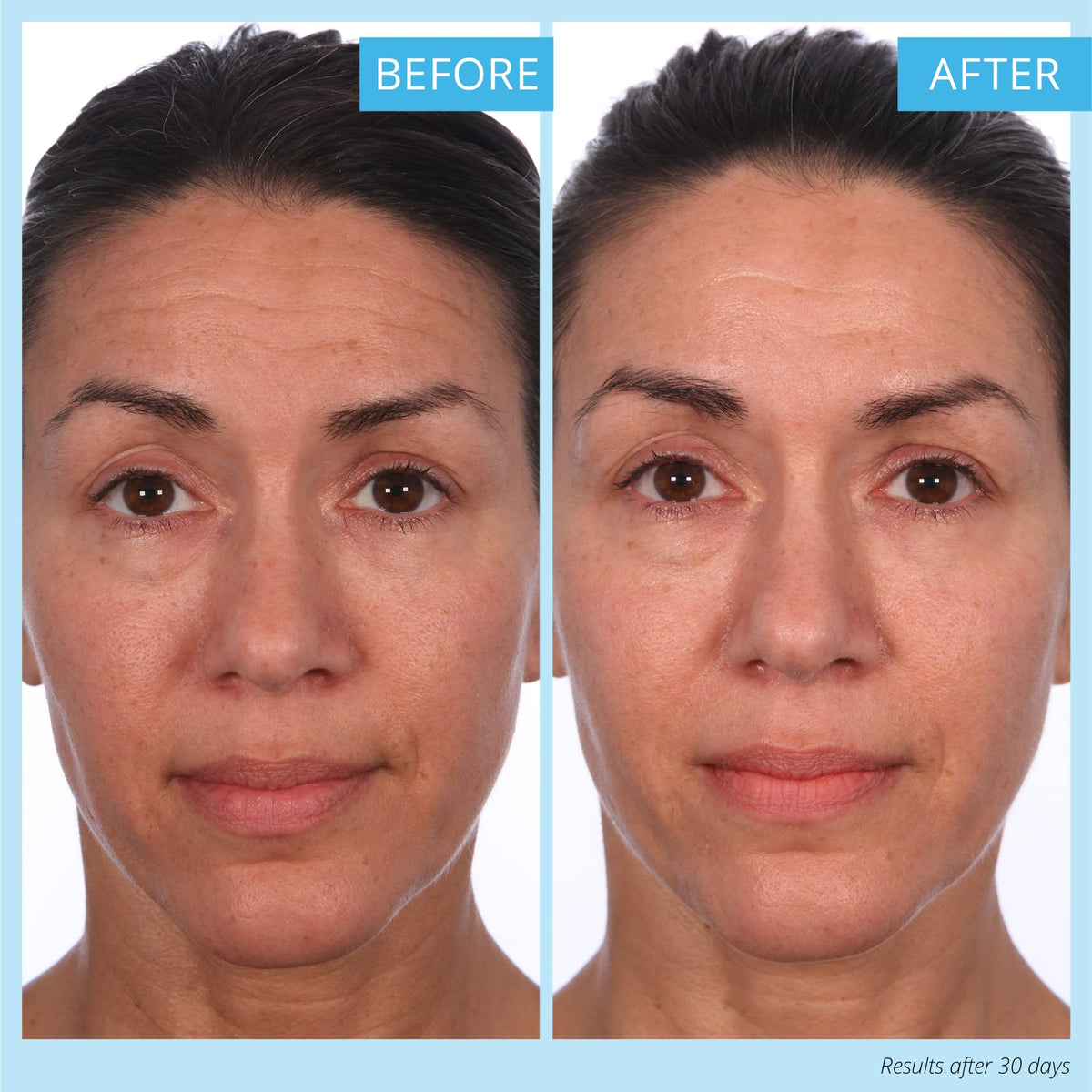 SKINN Crème Reverse face-and-neck application shows even absorption across skin areas.