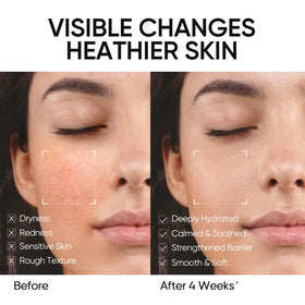 SKINTIFIC hyaluronic-acid-bottle highlights deep moisture and 24-hour hydration