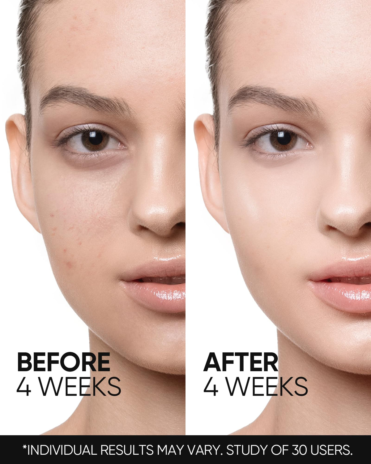 Close-up of skin barrier protection with SKINTIFIC moisturizer.