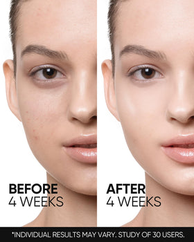 Close-up of skin barrier protection with SKINTIFIC moisturizer.