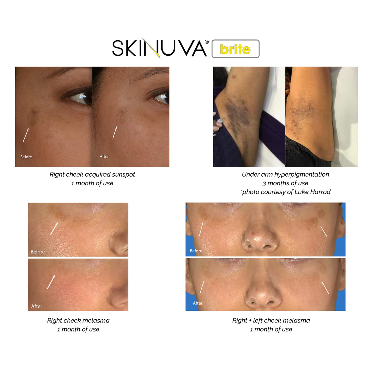 Close-up of Skinuva Brite ingredients with vitamin C and niacinamide.