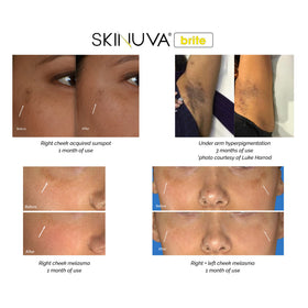 Close-up of Skinuva Brite ingredients with vitamin C and niacinamide.