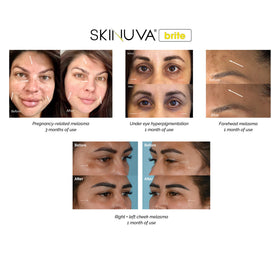 Skinuva Brite label close-up emphasizing growth factors and tranexamic acid.