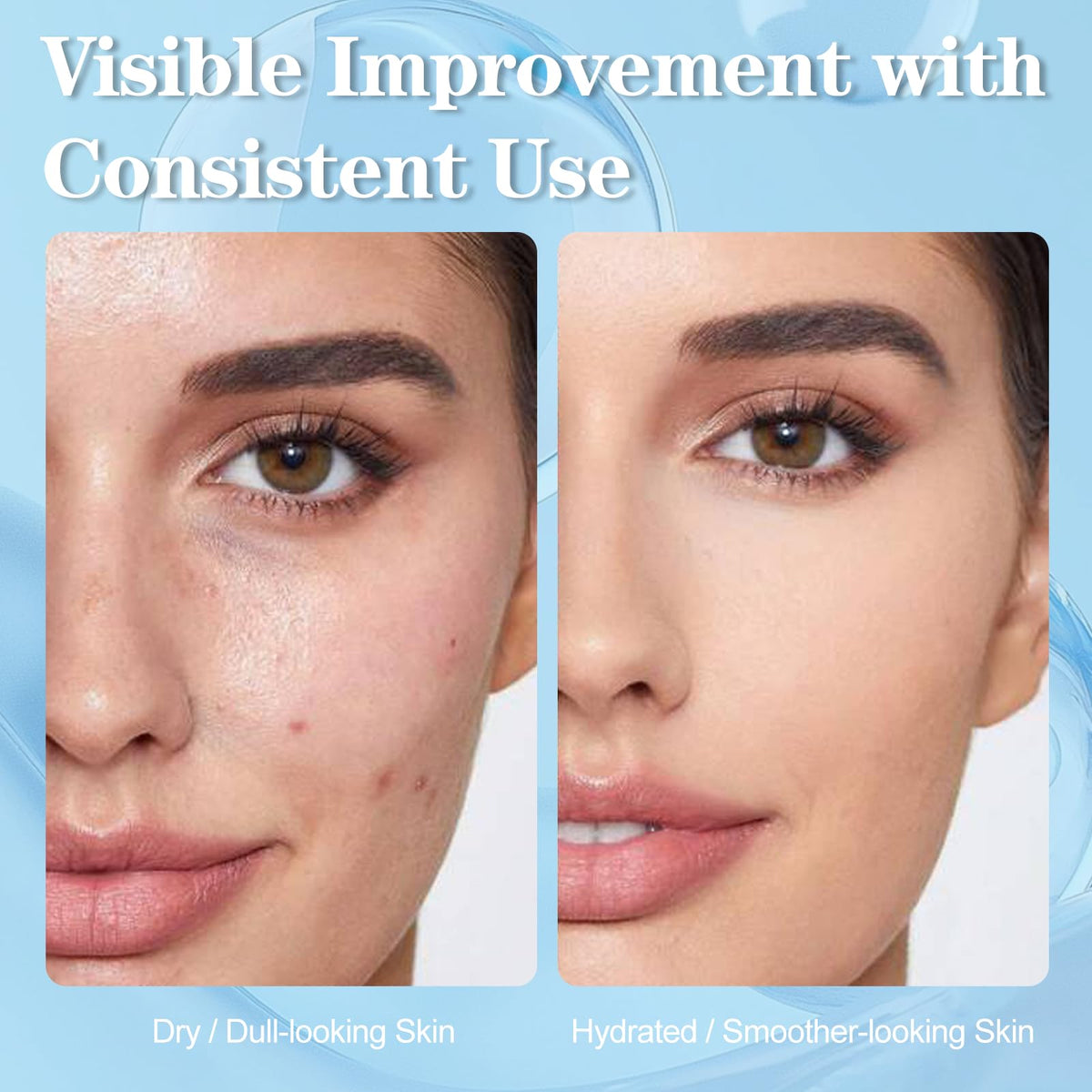 SKSOYT hyaluronic-acid serum bottle highlighting hydration and a dewy glow