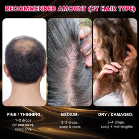 SKSOYT Onion Hair Growth Serum packaging and 60 ml bottle.