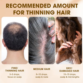 SKSOYT Onion Oil routine use supports flexible care for all hair types.