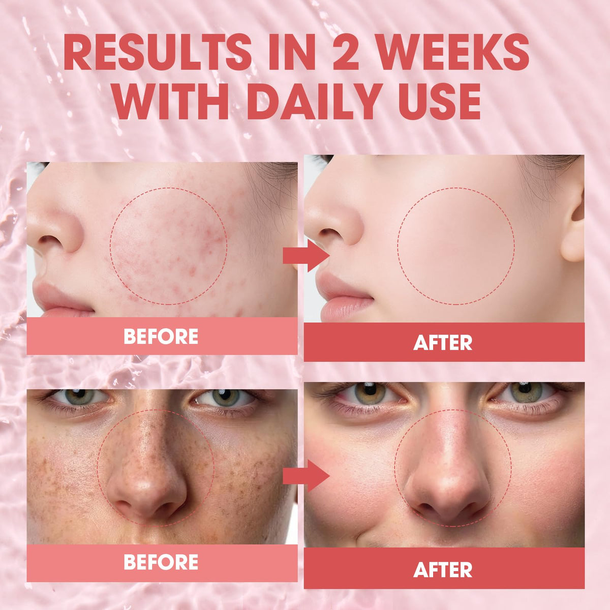 SKSOYT packaging highlights salmon DNA PDRN and peptides for anti-aging support.