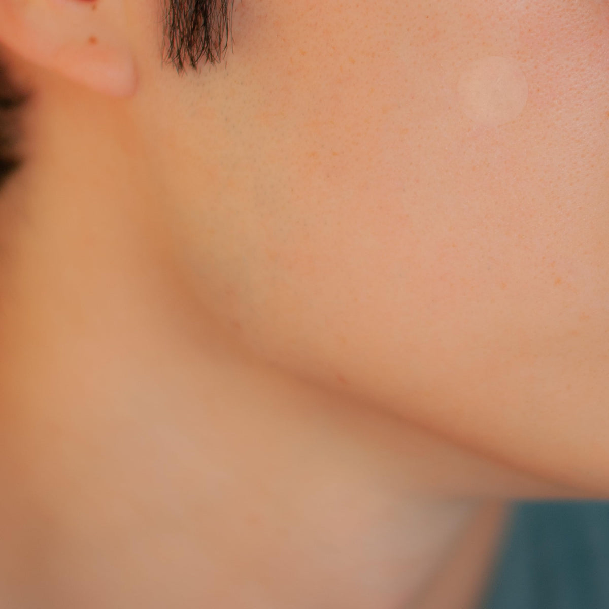SMARTMED Cover Dot protective cover guards blemishes from touching and dirt.