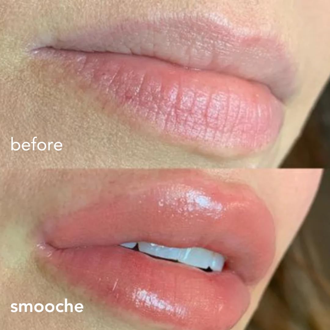 Smooche hyaluronic acid hydration for moisturized, supple lips