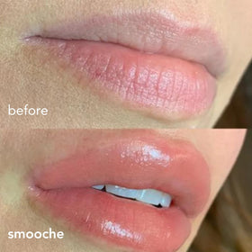 Smooche hyaluronic acid hydration for moisturized, supple lips