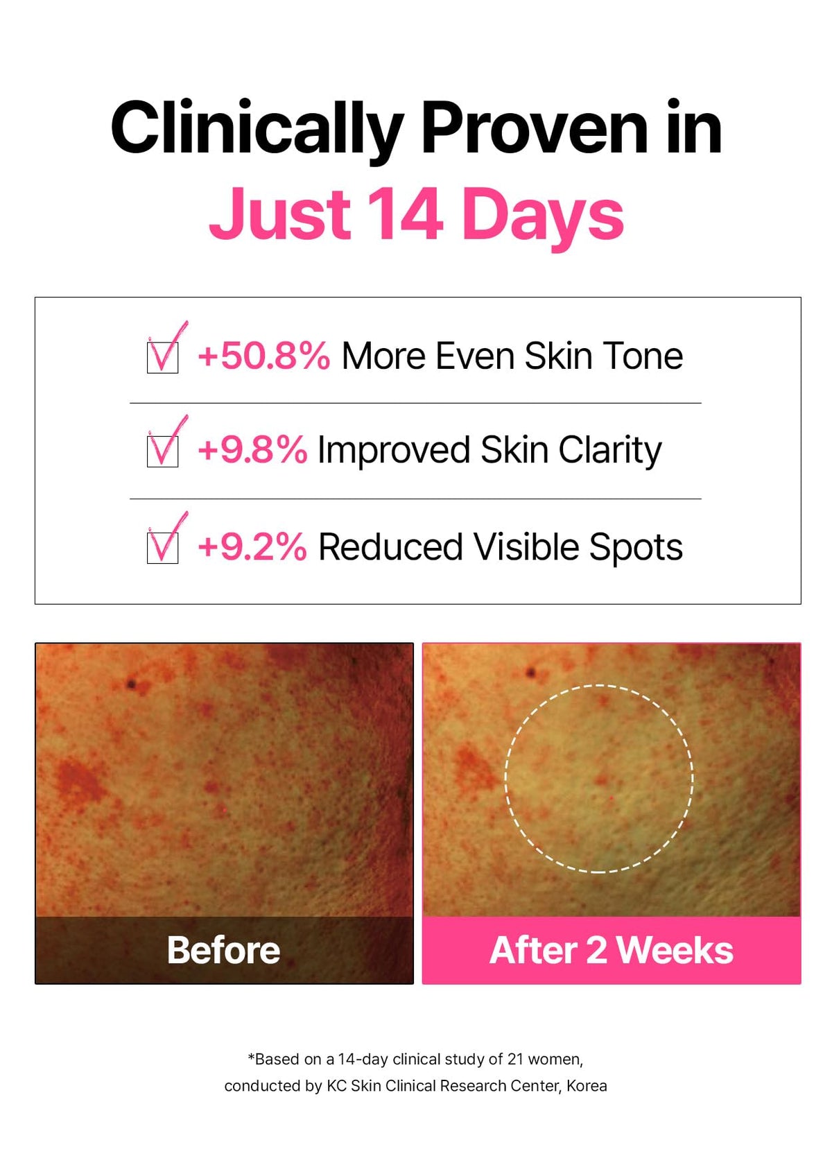 SNP pink vitamin C cherry blossom pad tones and brightens complexion.