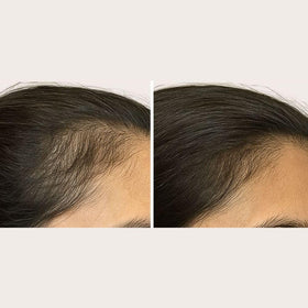 Solaris Laboratories NY Intensive Hair Stimulating Brush bristles detail showing dual wavelengths for healthier strands.