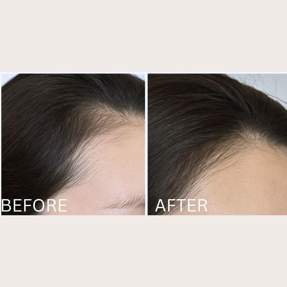 Solaris Laboratories NY Intensive Hair Stimulating Brush side angle demonstrates compact ergonomics for daily use.