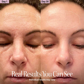 Solawave wand jawline contouring supports firmer, defined facial lines.